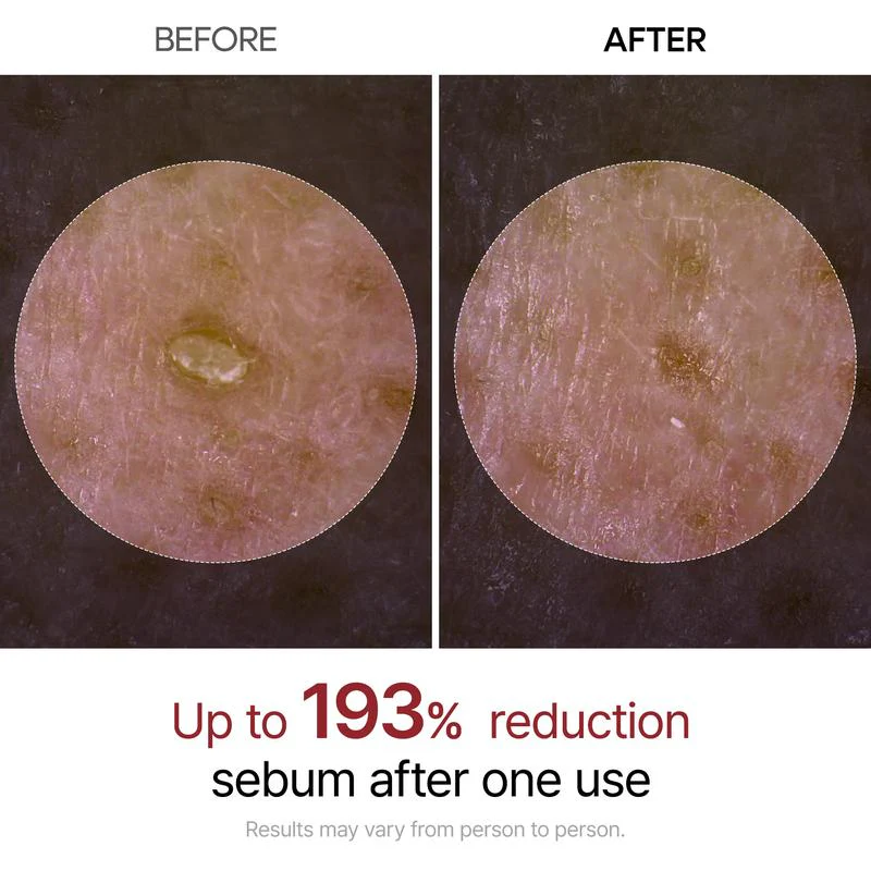 Peel Shot Glow - Image 2